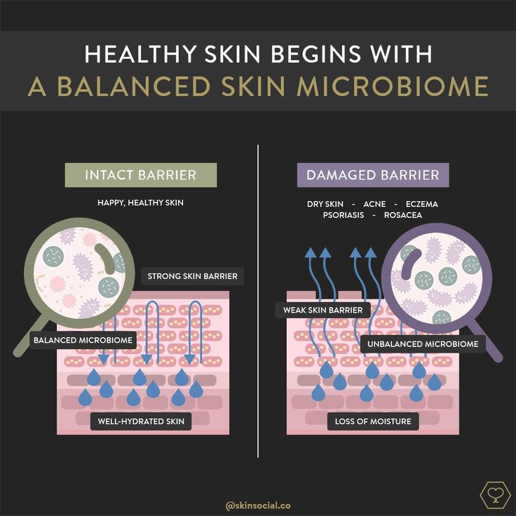 Mất cân bằng hệ vi sinh trên da